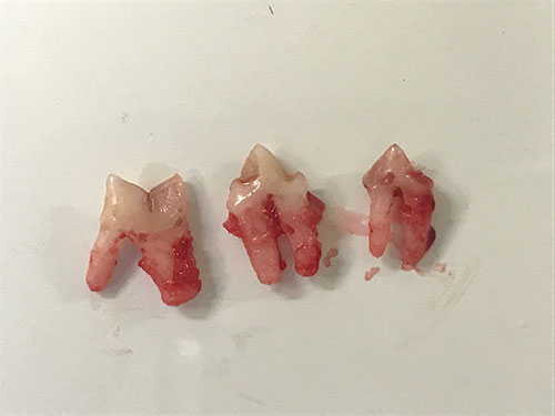 猫の歯肉口内炎