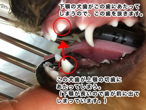 乳歯遺残